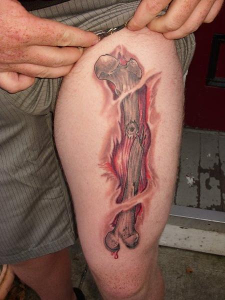 Art Galleries - Tom Strom - Broken Femur bone