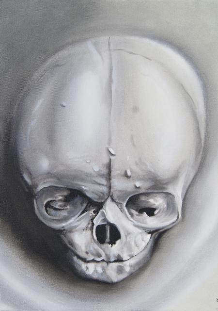 Hal Sawyer - Fetal skull