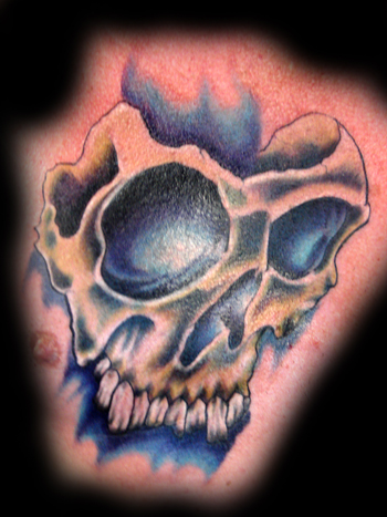 Aaron Grace - broken skull