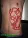 tattoos/ - Skin Removal - 52814