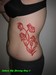 tattoo galleries/ - Skin Removal