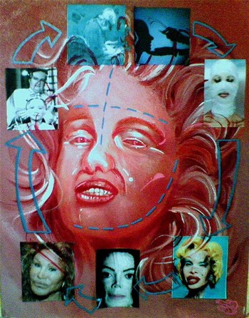 Plastic+surgery+disasters