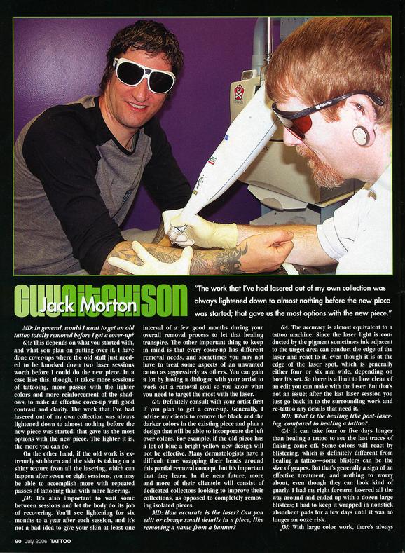  - Laser Article, Tattoo Mag, 2006, Page 5