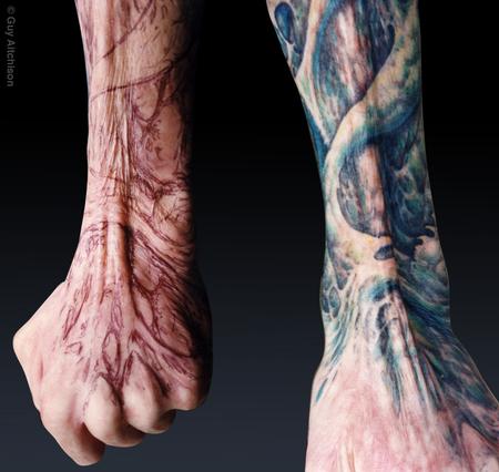 Guy Aitchison - Grime, third degree burn scar coverup