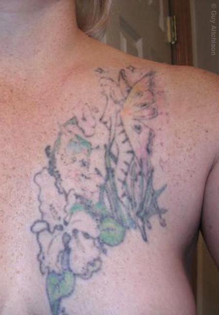 Tattoos - Suzanne, after four laser sessions - 71541