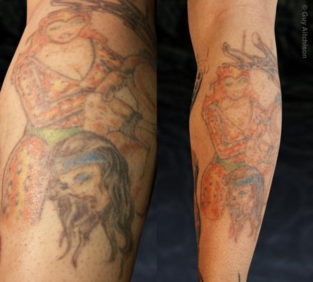 Tattoos - Hiro, first and second laser sessions - 71545