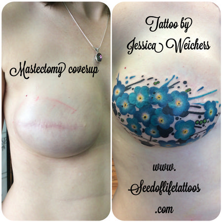 Jessica Weichers - Floral mastectomy coverup