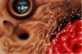 Nick Baxter - tumor