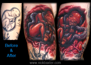 Tattoos - Fetus Rework - 9020