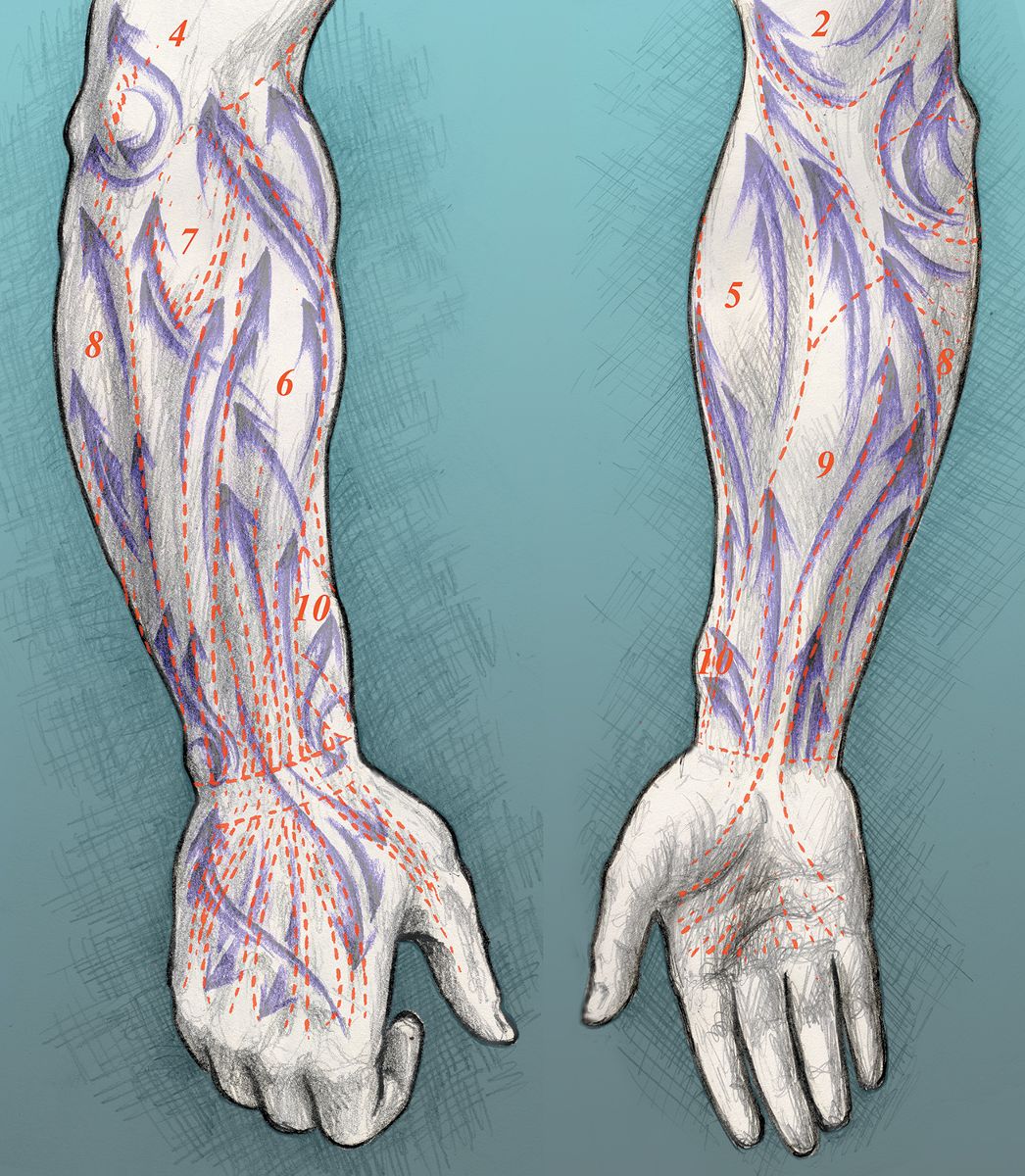 Fig. 14b