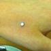 Tattoos - Hand Dermal - 61334