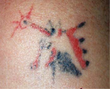 Bad Tattoos - Unicorn
