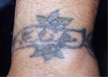 Really bad tattoo - Banner