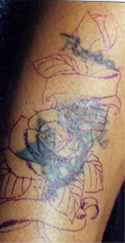 Bad Tattoos - Flower
