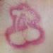 Tattoos - Cherry? Music Note? Really bad rash? - 71946