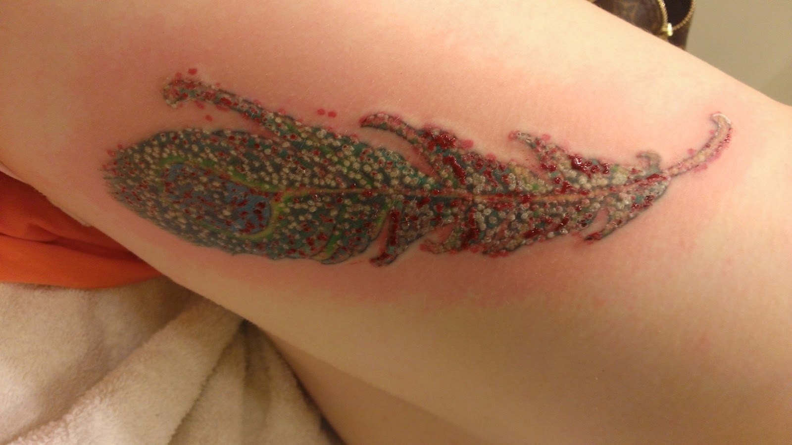 :6 Signs Your Tattoo is Infected Cap1 Tattoos