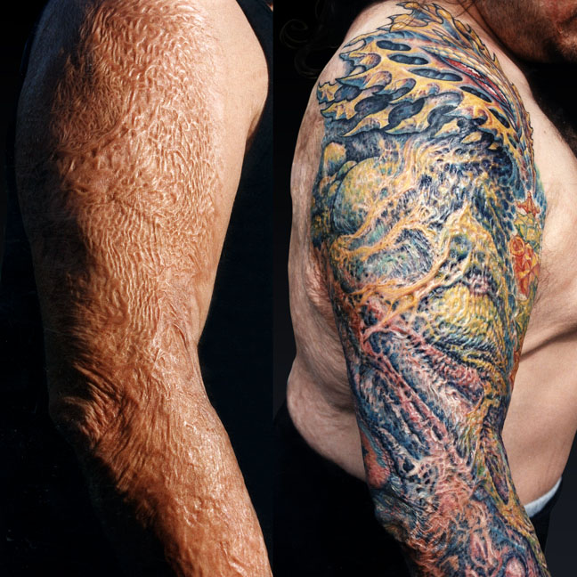 Es Malo Tatuarse Sobre Las Cicatrices El Arte De La Piel