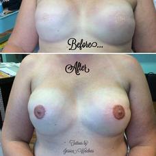 Tattoos - Areola / Nipple Reconstruction Tattoo - 120223