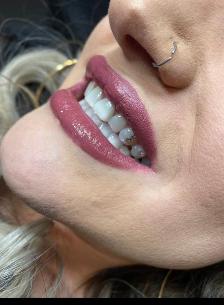 Asia Vetter (PORTLAND) - Lips toothgems