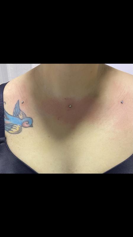 Tattoos - Dermal - 142573