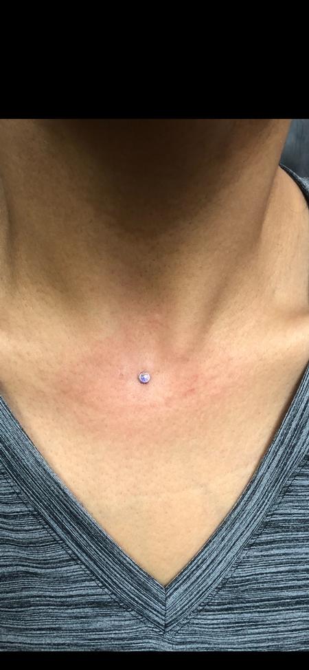 Jen West (MARICOPA) - Dermal