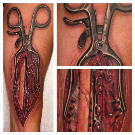Tattoos - Forceps Opening Forearm - 93658