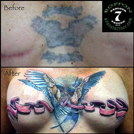 Tattoos - Mastectomy scar cover-up tattoo - 87349