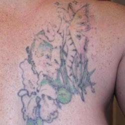 Tattoos - Suzanne, after four laser sessions - 71541