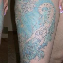 Tattoos - Suzanne, after 10 laser sessions - 71555